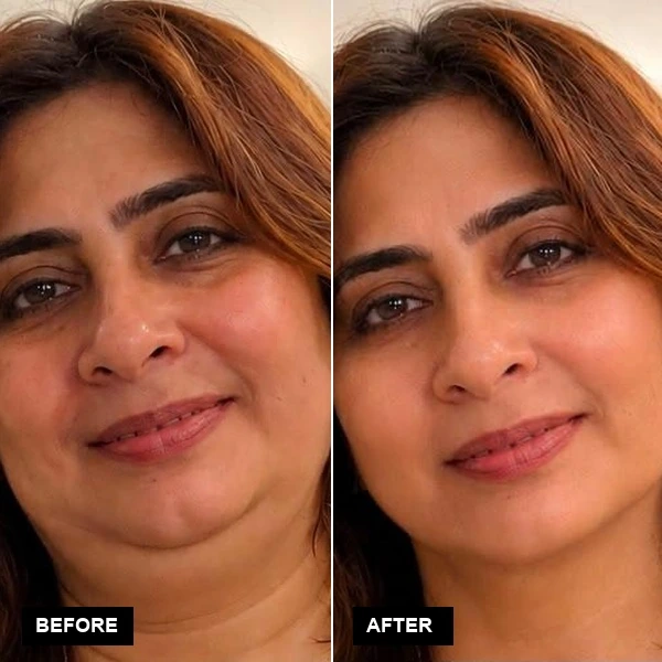 Facial Sculpt & Radiance Lift Before and After